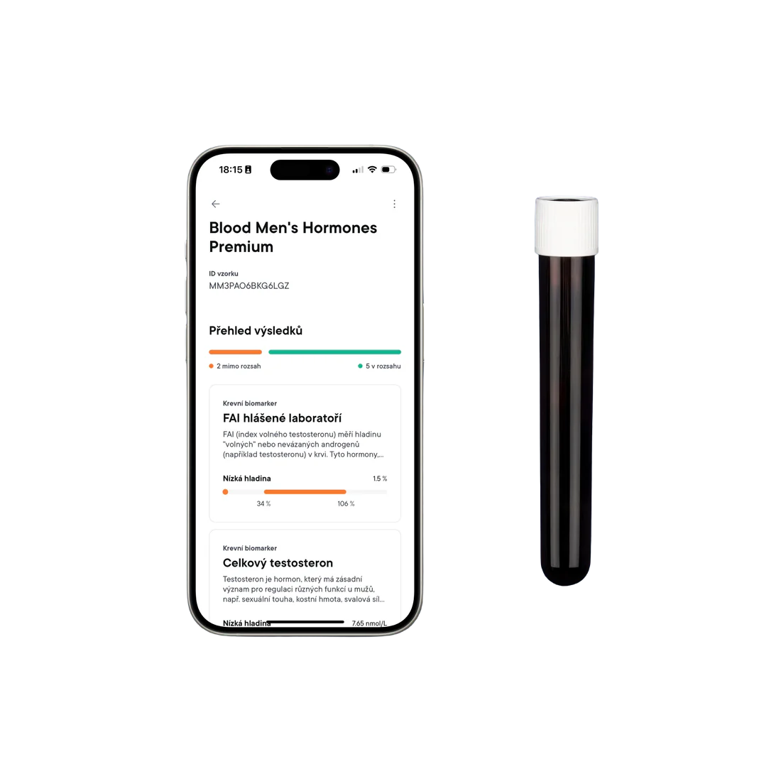 MACROMO Mužské hormony Krevní test